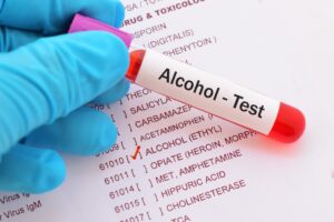 alcohol test