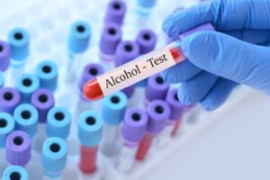 DoctorHoldingATestBloodSampleTubeWithAlcoholTest
